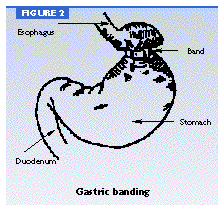 Feeling Of Fullness After Eating Small Amounts Of Food Feeling Of Fullness After Eating Small Amounts Of Food